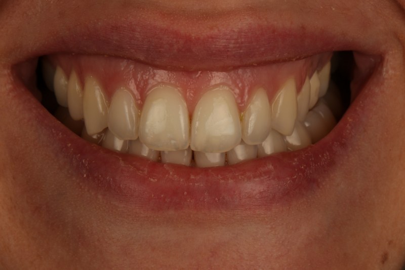 After - Cheadle Hulme Dental