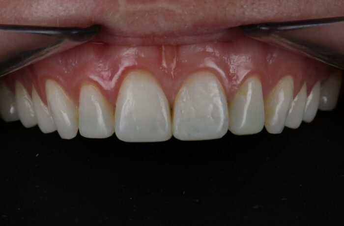 After - Cheadle Hulme Dental