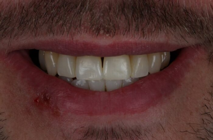 After - Cheadle Hulme Dental