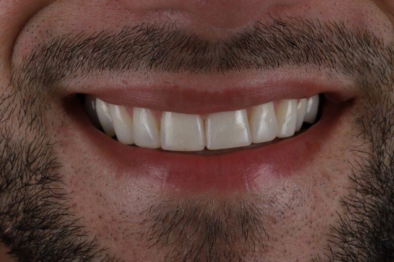 After - Cheadle Hulme Dental