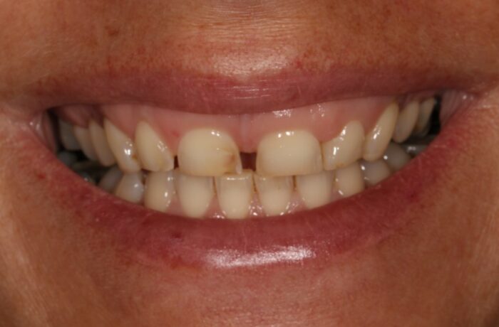 Before - Cheadle Hulme Dental