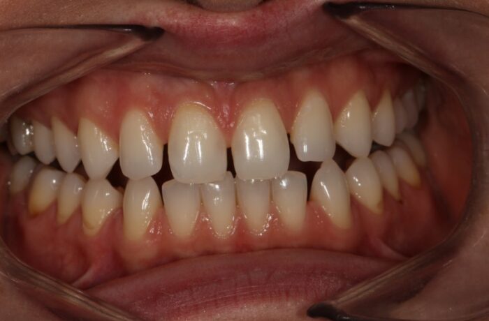 Before - Cheadle Hulme Dental