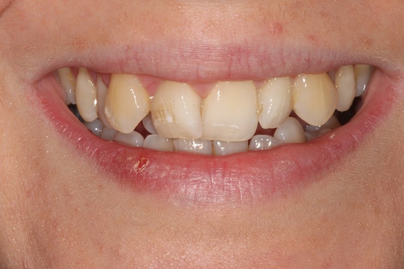 Before - Cheadle Hulme Dental