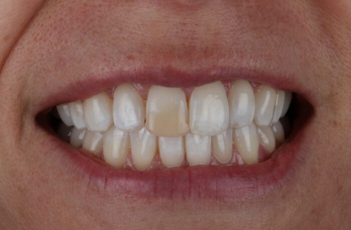 Before - Cheadle Hulme Dental