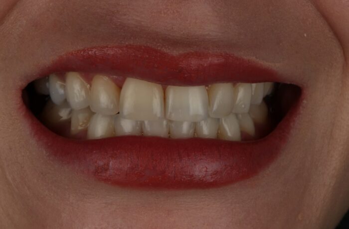 After - Cheadle Hulme Dental