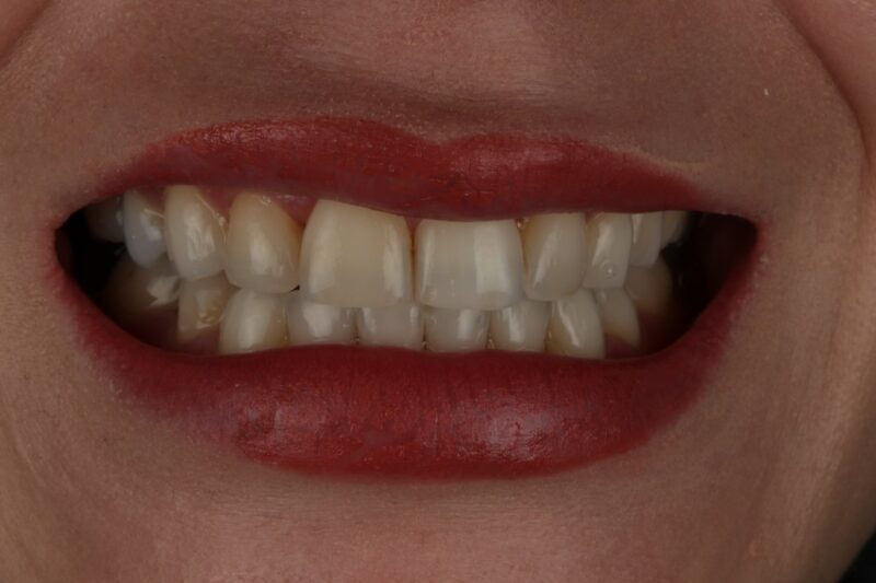 After - Cheadle Hulme Dental