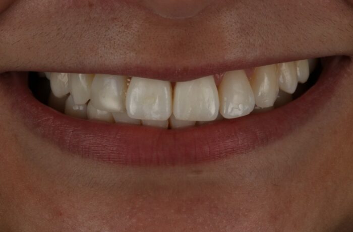After - Cheadle Hulme Dental