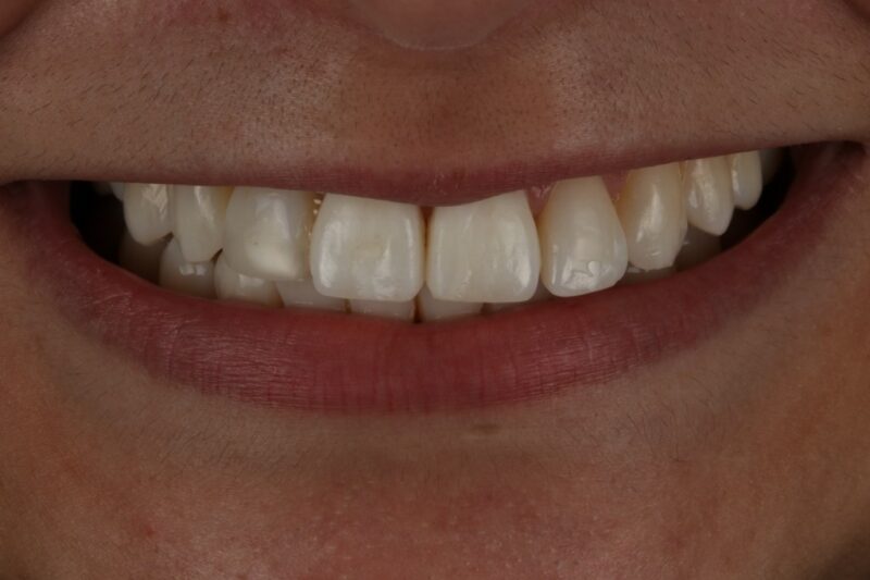 After - Cheadle Hulme Dental