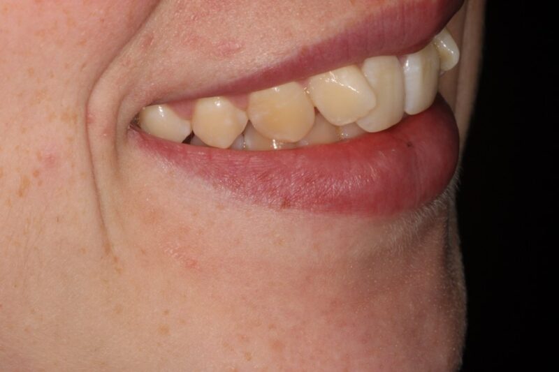 Before - Cheadle Hulme Dental