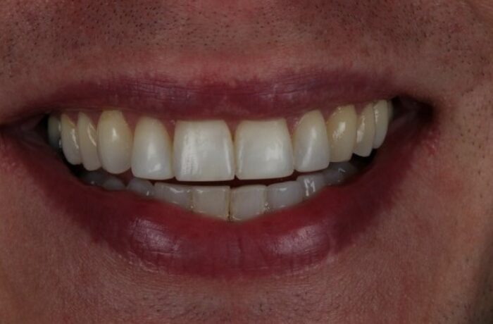 After - Cheadle Hulme Dental