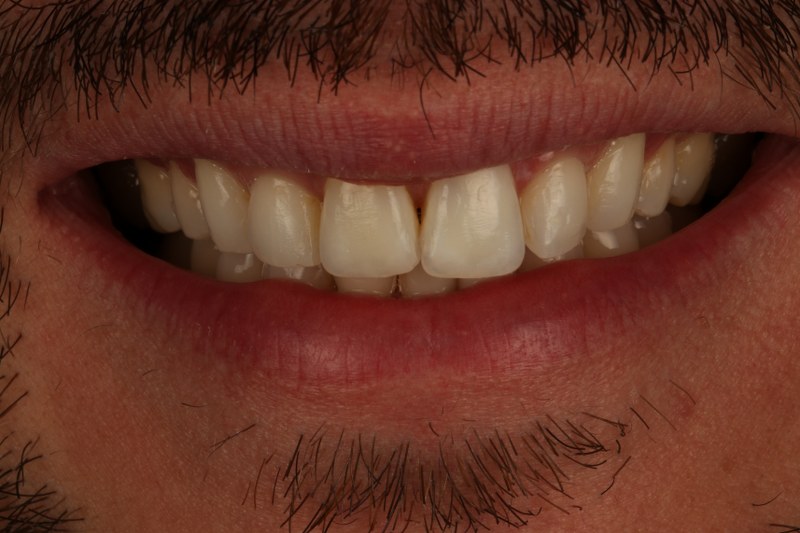 After - Cheadle Hulme Dental