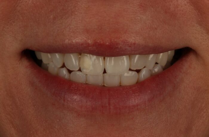 After - Cheadle Hulme Dental