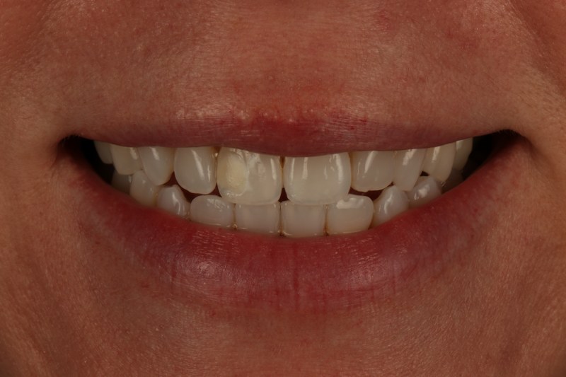 After - Cheadle Hulme Dental