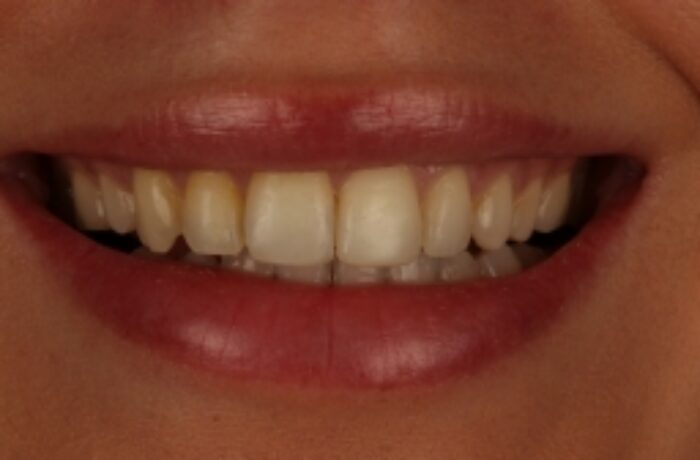 After - Cheadle Hulme Dental