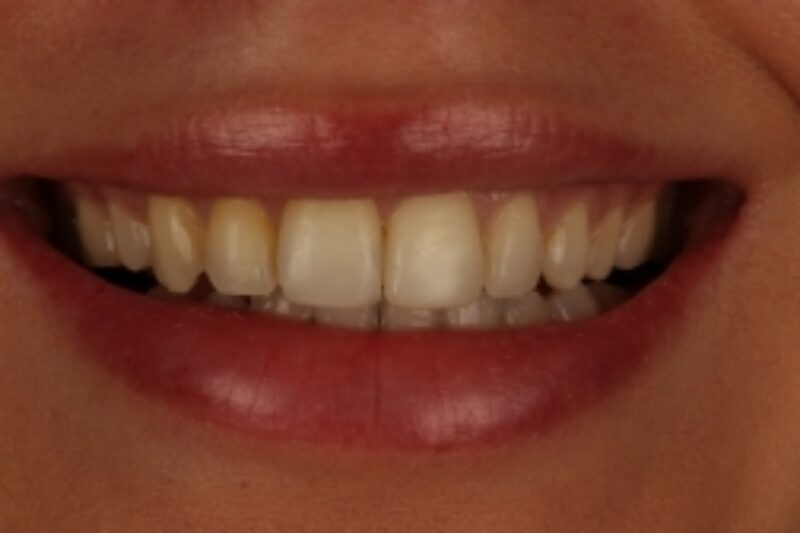 After - Cheadle Hulme Dental