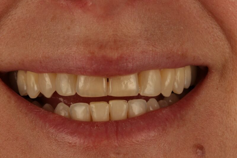 After - Cheadle Hulme Dental