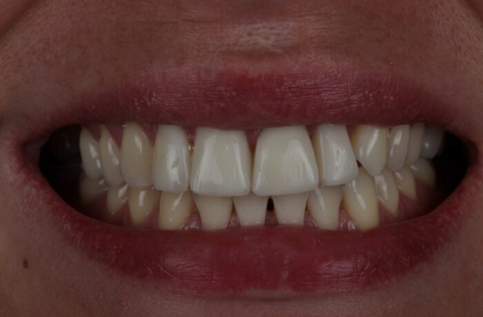 After - Cheadle Hulme Dental
