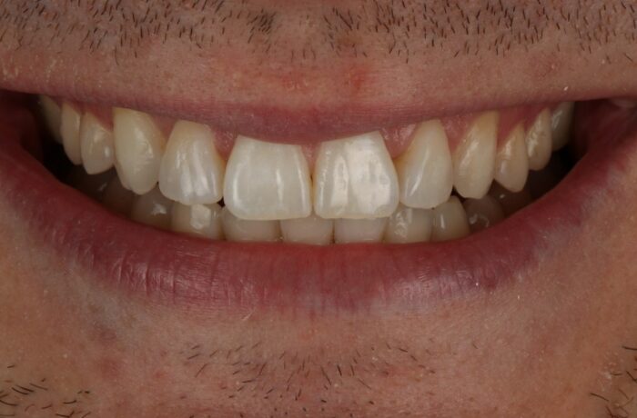 After - Cheadle Hulme Dental