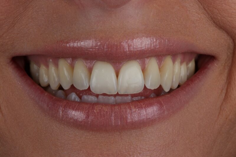 After - Cheadle Hulme Dental