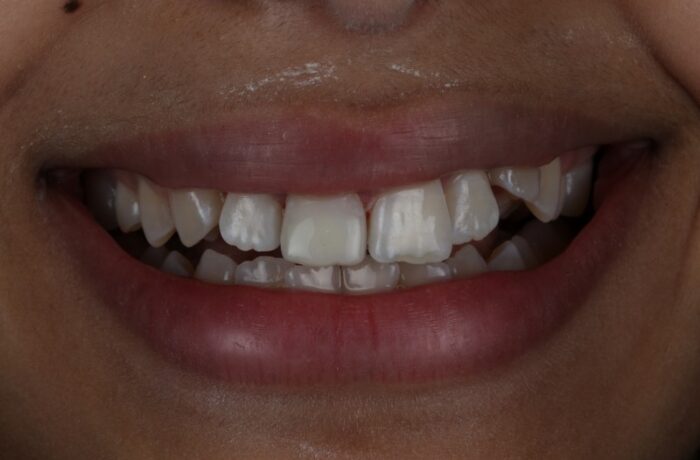 After - Cheadle Hulme Dental