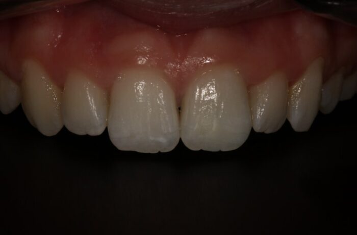 After - Cheadle Hulme Dental