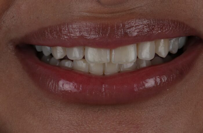 After - Cheadle Hulme Dental