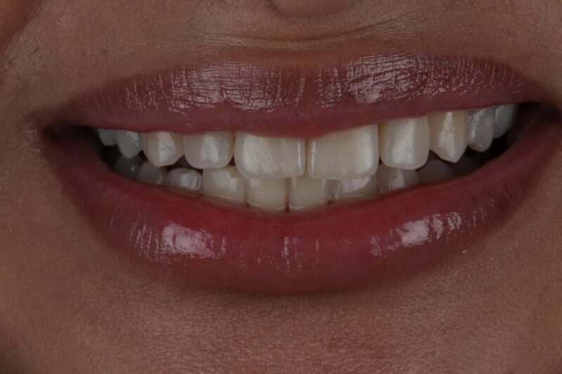 After - Cheadle Hulme Dental