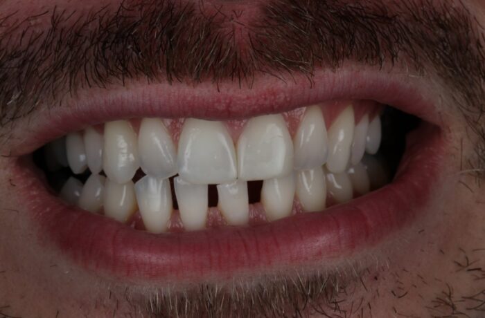 After - Cheadle Hulme Dental