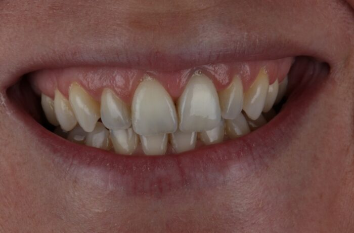 After - Cheadle Hulme Dental