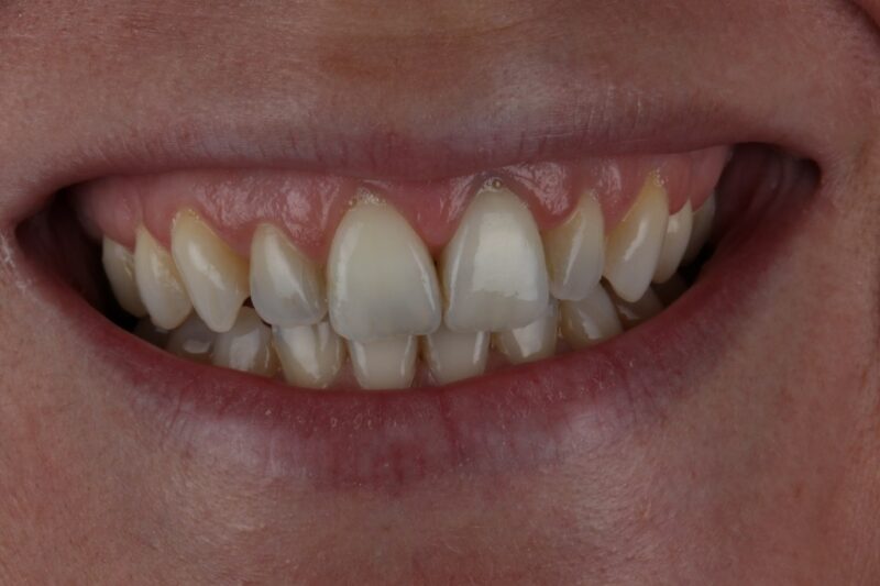 After - Cheadle Hulme Dental