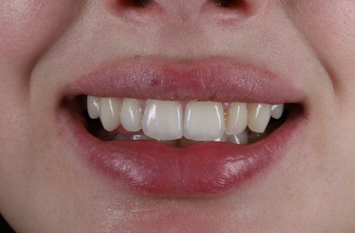 After - Cheadle Hulme Dental