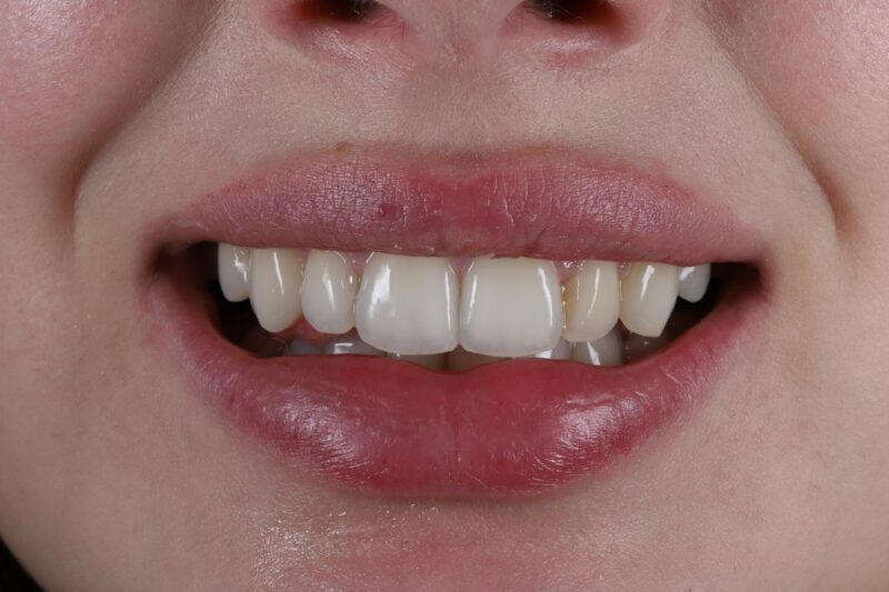 After - Cheadle Hulme Dental