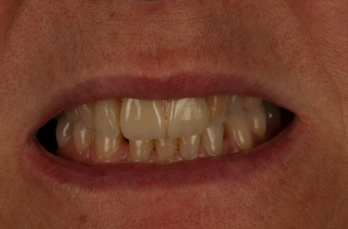 After - Cheadle Hulme Dental