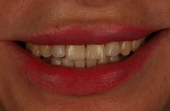 After - Cheadle Hulme Dental