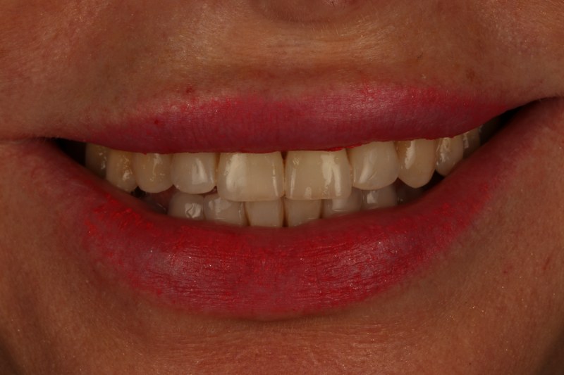 After - Cheadle Hulme Dental