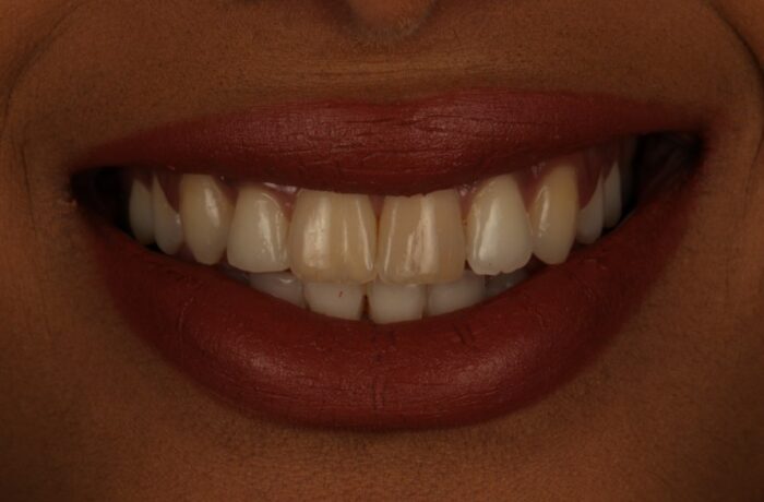 After - Cheadle Hulme Dental