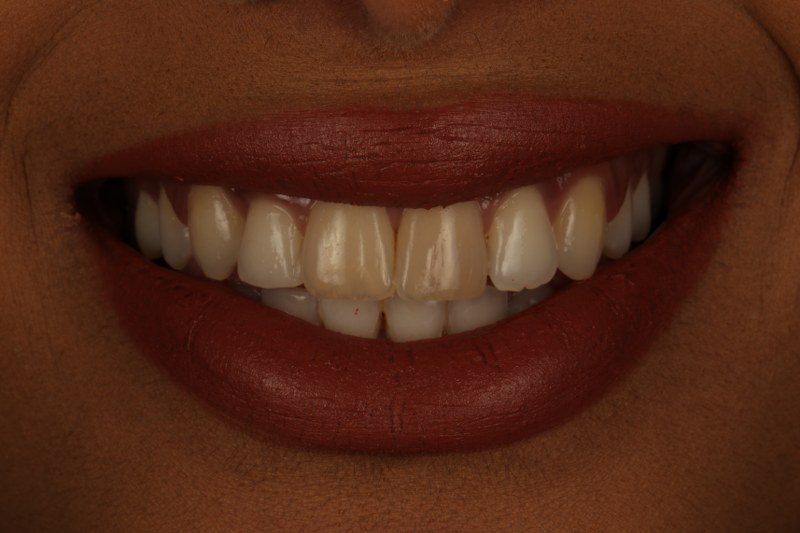 After - Cheadle Hulme Dental