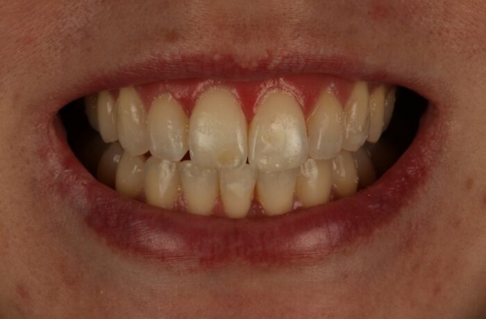 After - Cheadle Hulme Dental