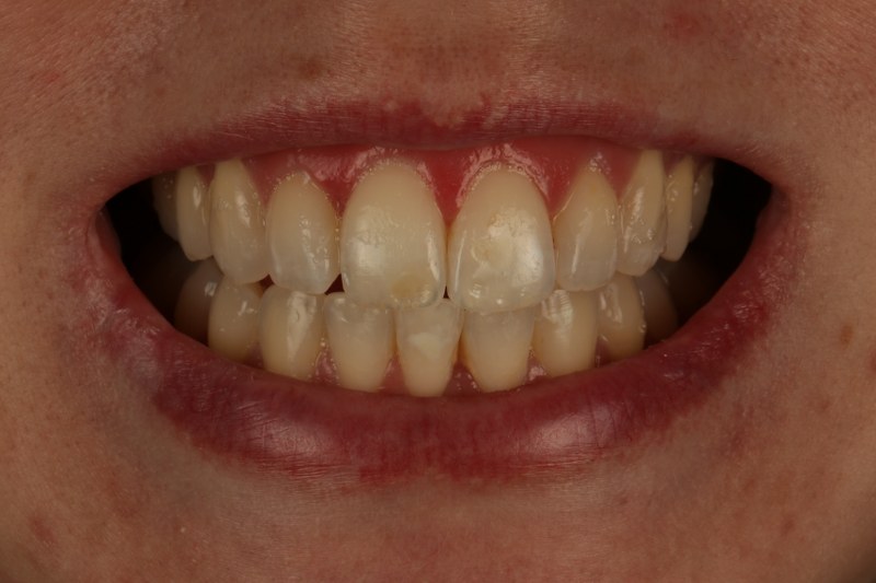 After - Cheadle Hulme Dental
