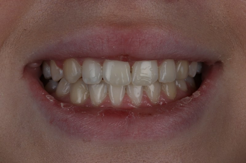After - Cheadle Hulme Dental