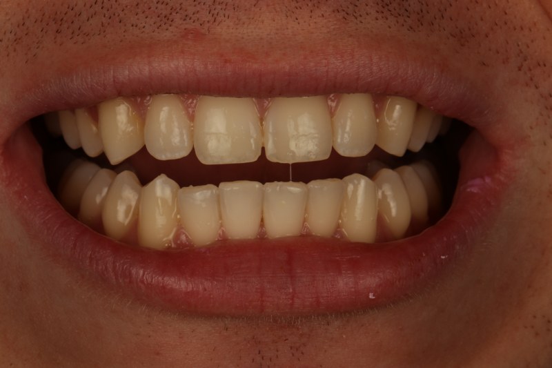 After - Cheadle Hulme Dental