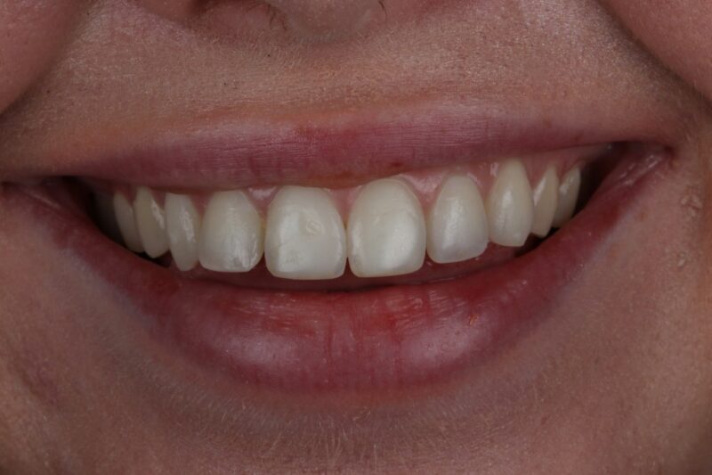 After - Cheadle Hulme Dental