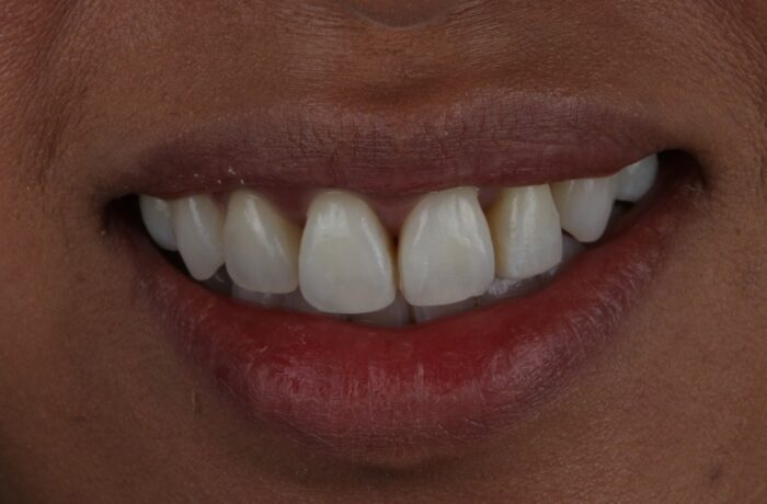 After - Cheadle Hulme Dental