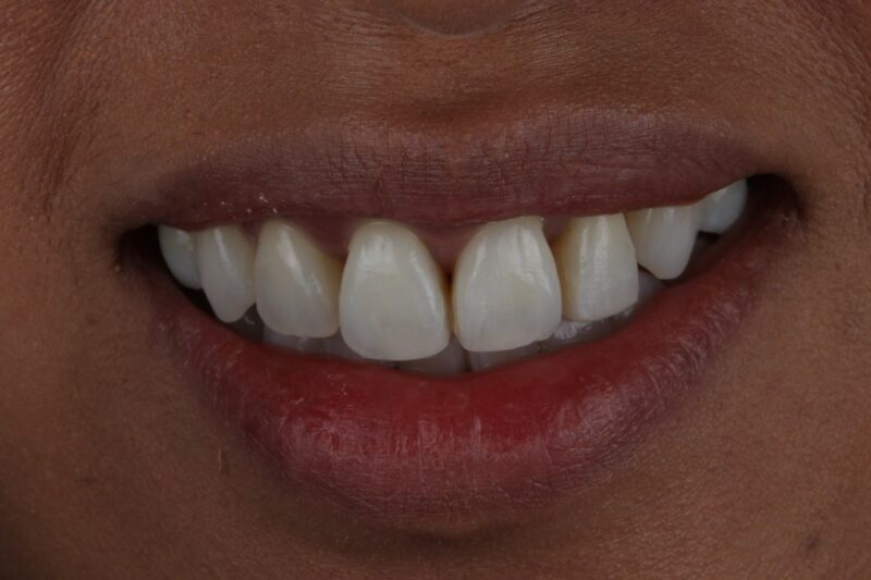 After - Cheadle Hulme Dental