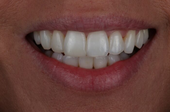 After - Cheadle Hulme Dental