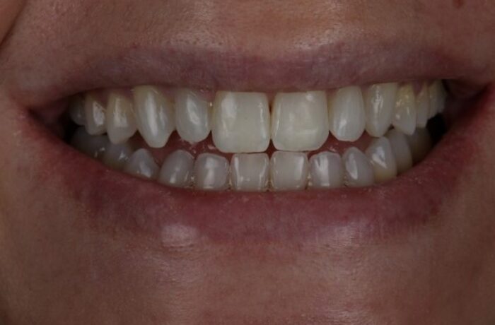 After - Cheadle Hulme Dental