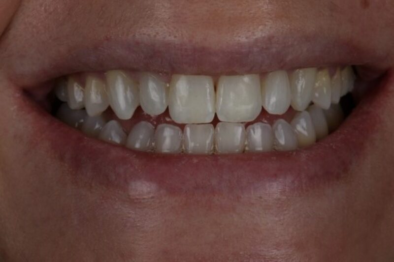 After - Cheadle Hulme Dental