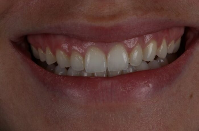 After - Cheadle Hulme Dental