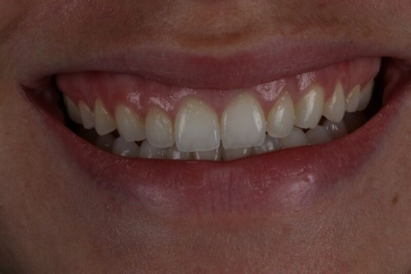 After - Cheadle Hulme Dental