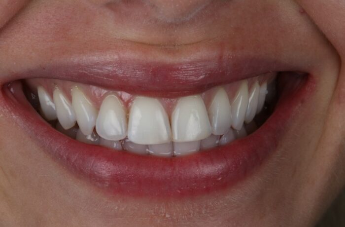 After - Cheadle Hulme Dental